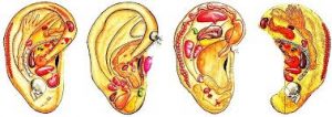 Auriculotherapy is the therapeutic method using the ear pinna.ent