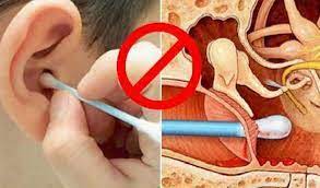 Avoid earwax removal with cue tips.ent